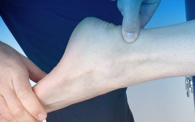 3 Reasons Why You Continue to Run into Persistent Achilles Pain